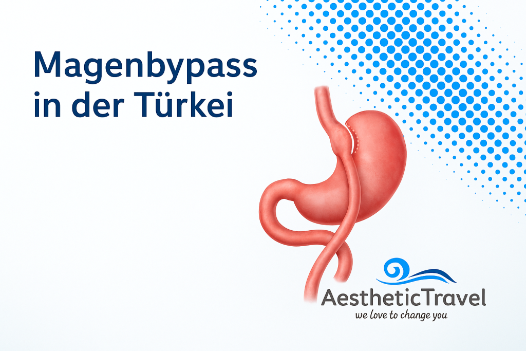 Magenbypass in der Türkei bei Aesthetic Travel