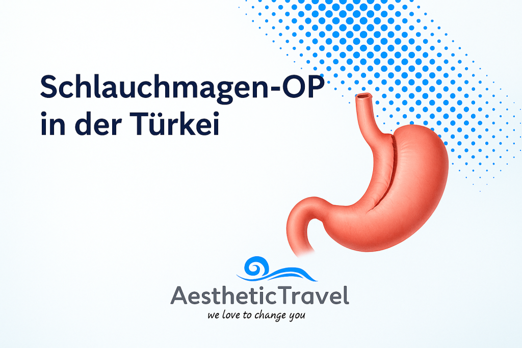 Schlauchmagen-OP in der Türkei bei Aesthetic Travel
